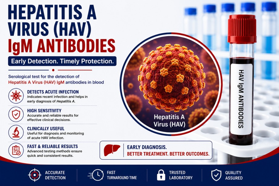 Hepatitis A Virus (HAV) IgM Antibody blood test for diagnosing acute hepatitis A infection using a serum sample in a diagnostic laboratory.