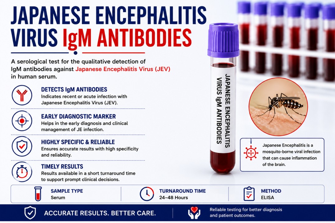 Japanese Encephalitis Virus (JEV) IgM Antibody blood test for detecting recent Japanese encephalitis infection using a serum sample.