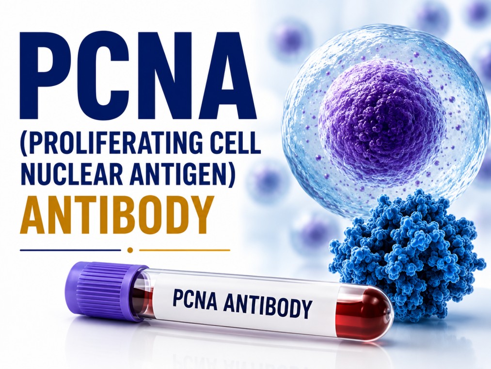 PCNA (Proliferating Cell Nuclear Antigen) antibody blood test for supporting the diagnosis of systemic lupus erythematosus using a serum sample.
