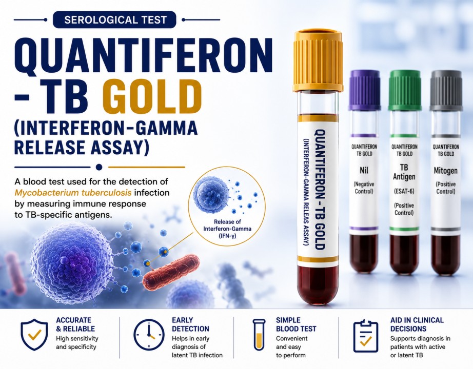 QuantiFERON-TB Gold Plus interferon-gamma release assay using whole blood to detect immune sensitization to Mycobacterium tuberculosis.