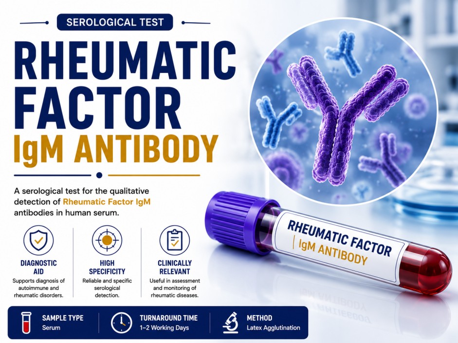 Rheumatoid Factor IgM antibody blood test for evaluating rheumatoid arthritis and autoimmune inflammatory joint diseases using a serum sample.
