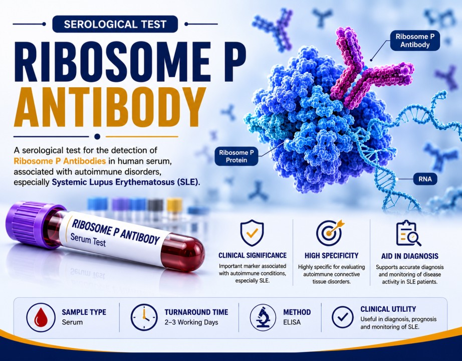 Ribosomal P antibody serum test for supporting the evaluation of systemic lupus erythematosus and selected neuropsychiatric lupus manifestations.