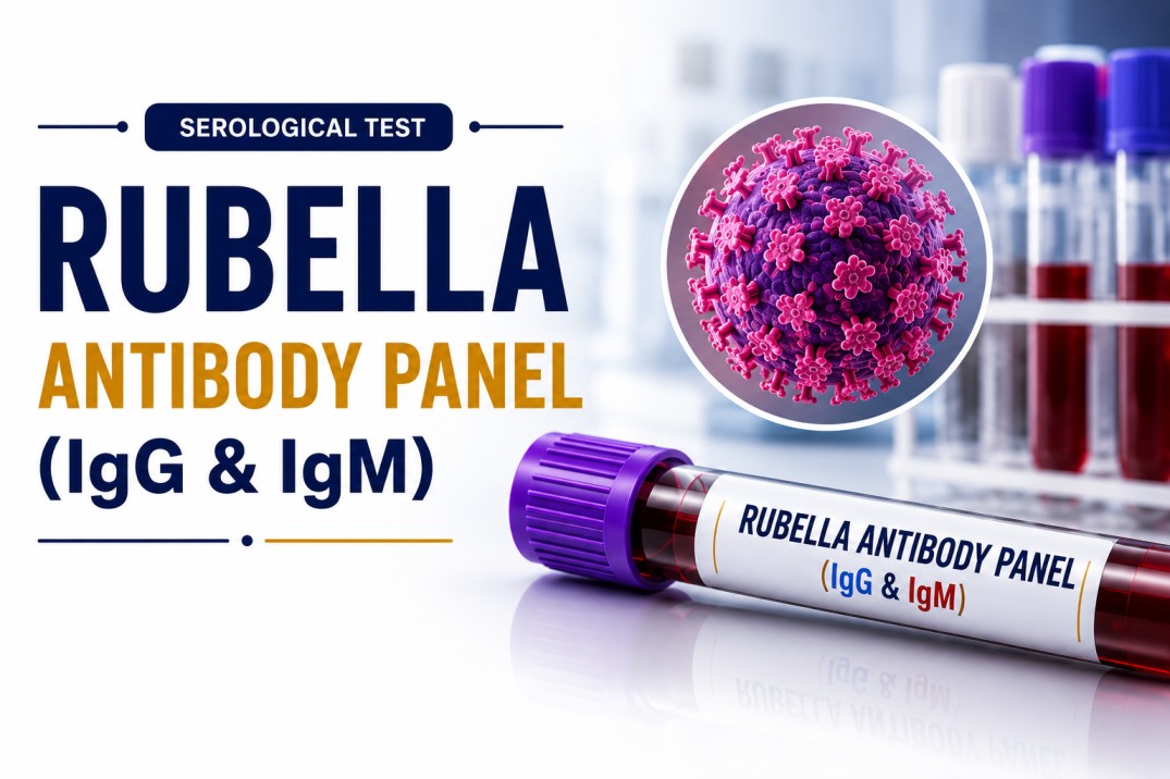 Rubella IgG and IgM antibody blood test for assessing immunity, recent infection, pregnancy screening, and congenital rubella syndrome evaluation.