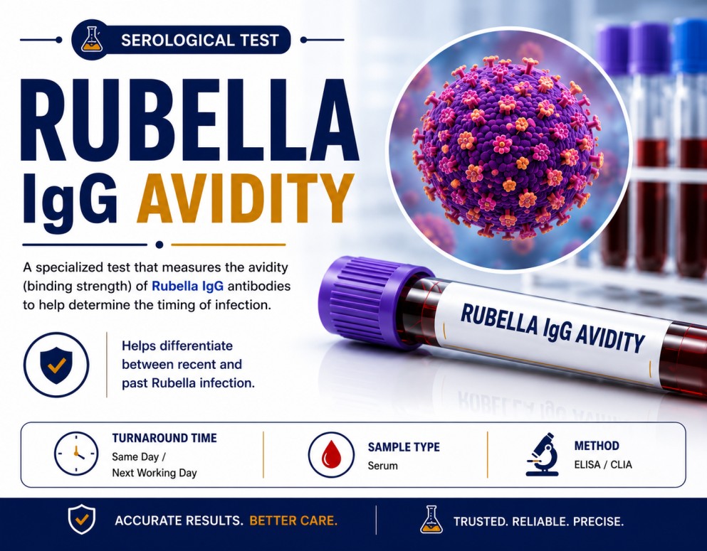 Rubella IgG avidity blood test for distinguishing recent primary rubella infection from past infection or vaccination during pregnancy evaluation.