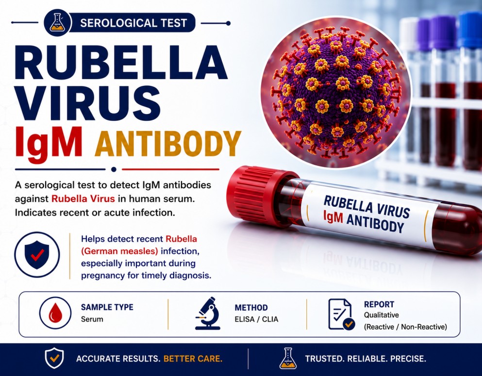 Rubella Virus IgM antibody blood test for evaluating recent rubella infection, rash illness, pregnancy exposure and congenital rubella risk.