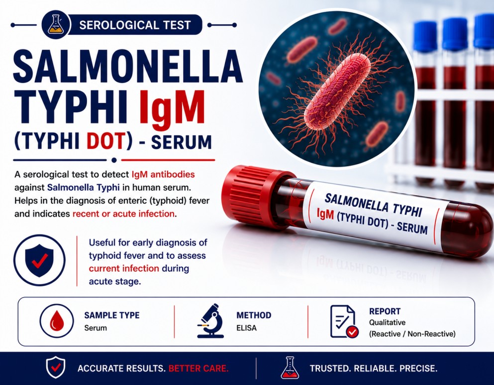 Salmonella Typhi IgM Typhidot serum antibody test for evaluating suspected recent typhoid fever and acute enteric fever.