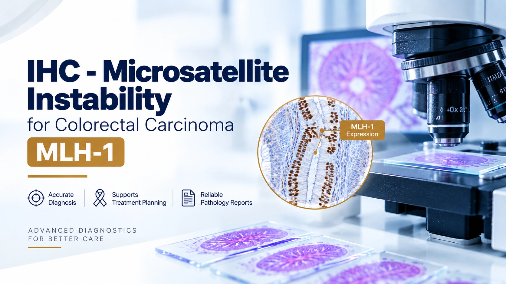 MLH1 immunohistochemistry staining in colorectal carcinoma tissue for microsatellite instability and Lynch syndrome screening